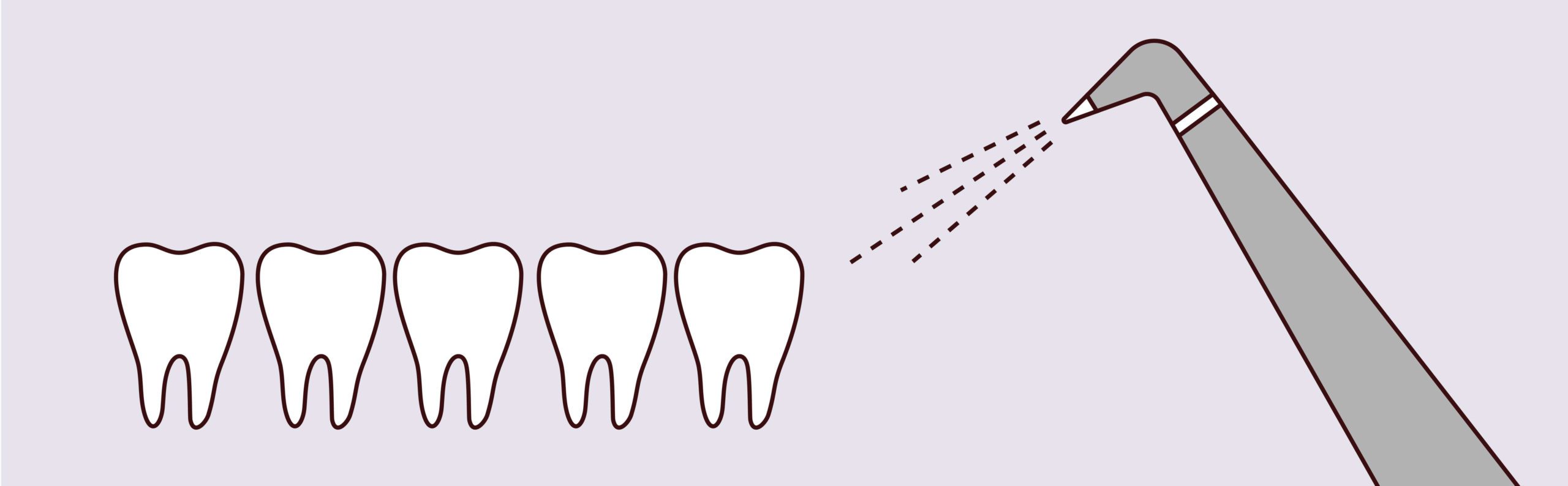 Air Abrasion Dentistry - Z Dental Care - Dreamscape Imagery 02 scaled - Z Dental Care -